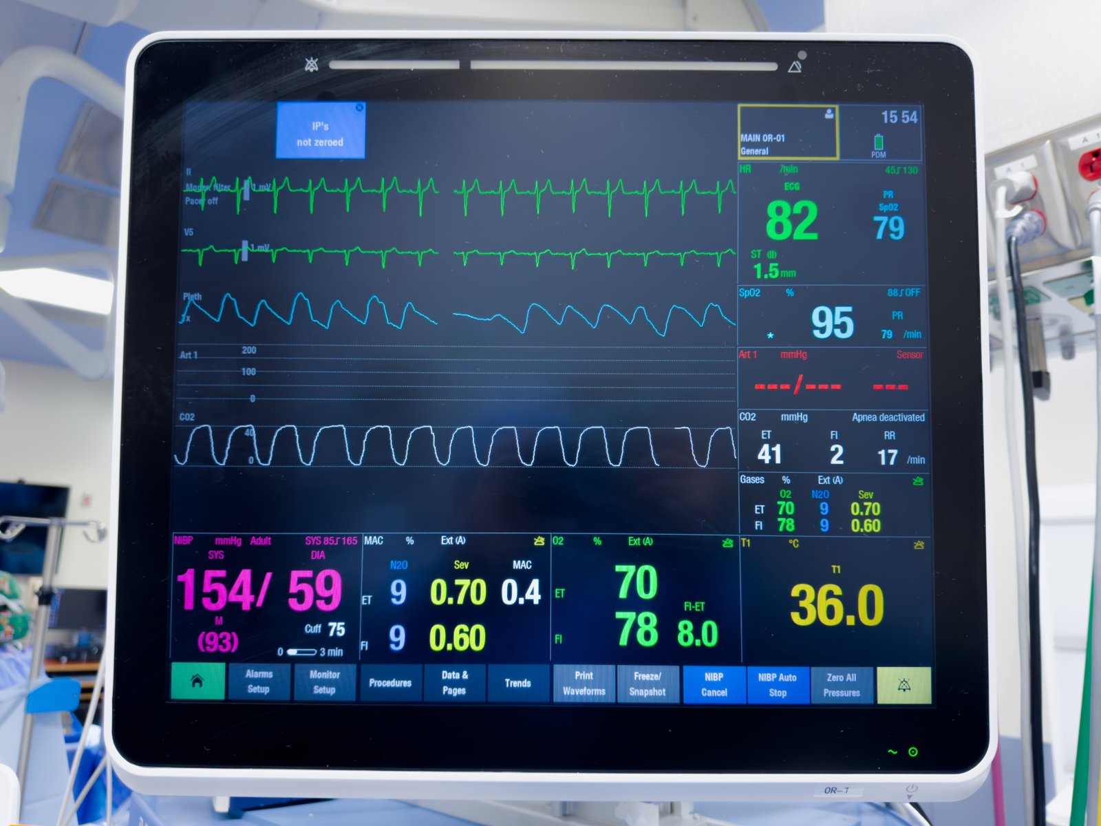 Cardiac Monitor on Rent in Noida